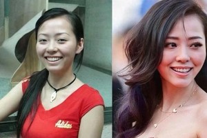 明星整容失败案例：张靓颖、李小璐等失去自然美