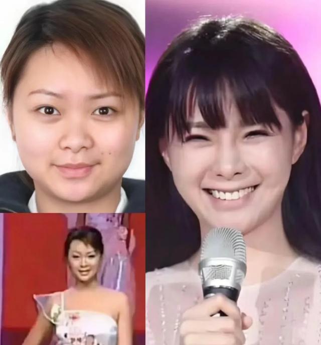 金晨鼻子变化对比